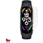 Screenshield fólie na displej pro XIAOMI Mi Band 7 XIA-MIB7-D – Hledejceny.cz