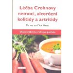 Dirk Klante: Léčba Crohnovy nemoci, ulcerózní kolitidy a – Zboží Mobilmania