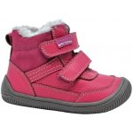 Protetika Tyrel koral – Sleviste.cz