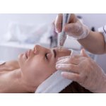 Mikrojehličková radiofrekvence: Omlazující procedura obličeje – Hledejceny.cz