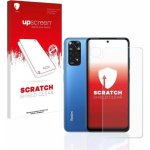 Ochranná fólie Hydrogel Xiaomi Redmi Note 11 / Note 11S – Sleviste.cz