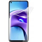 Ochranná fólie Hydrogel Xiaomi Redmi Note 9 – Zboží Mobilmania