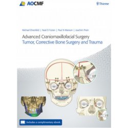 Advanced Craniomaxillofacial Surgery