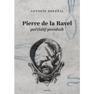 Pierre de la Ravel, pařížský porodník - Doležal Antonín