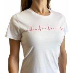 INFINITE MedStyle EKG bílé AV blok – Zboží Mobilmania