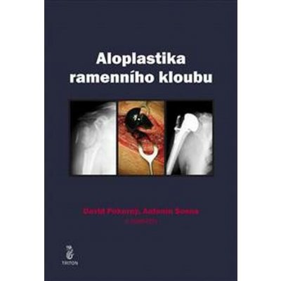 Aloplastika ramenního kloubu – Hledejceny.cz