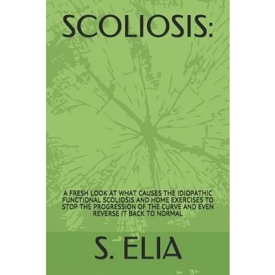 Scoliosis: : A Fresh Look at What Causes the Idiopathic Functional Scoliosis and Home Exercises to Stop the Progression of the Cu Elia S.Paperback