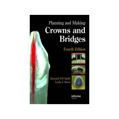 Planning and Making Crowns and - L. Howe, B. Smith – Hledejceny.cz