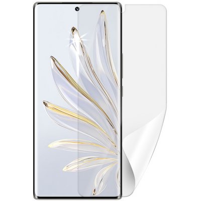 Ochranné fólie ScreenShield HUAWEI Honor 70 - displej – Hledejceny.cz