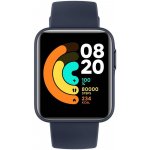 Xiaomi Redmi Watch 2 Lite – Hledejceny.cz