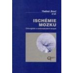 Ischémie mozku – Sleviste.cz