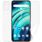 Ochranná fólie ScreenShield UMIDIGI A9 Pro - celé tělo – Zbozi.Blesk.cz