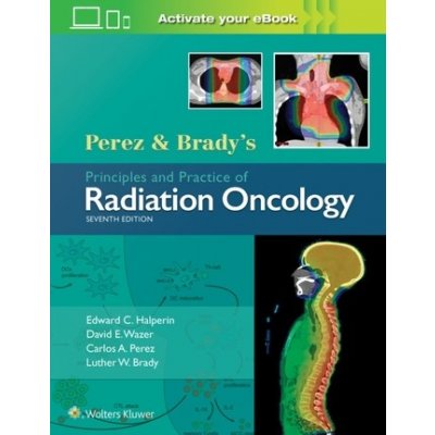 Perez a Brady's Principles and Practice of Radiation Oncology – Zbozi.Blesk.cz