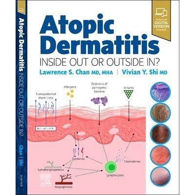 Atopic Dermatitis: Inside Out or Outside In – Zboží Mobilmania