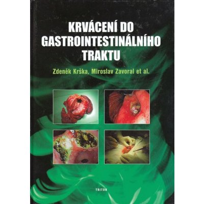 Krvácení do gastrointestinálního traktu – Hledejceny.cz