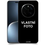 Acover Kryt na mobil Honor Magic 7 Pro s vlastní fotkou / motivem – Sleviste.cz
