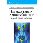 Infekce ledvin a močových cest - Teplan Vladimír, Horáčková Miroslava, Bébrová Eliška, Janda Jan, kolektiv – Hledejceny.cz