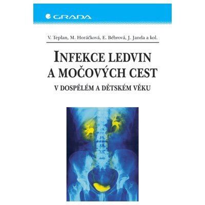 Infekce ledvin a močových cest - Teplan Vladimír, Horáčková Miroslava, Bébrová Eliška, Janda Jan, kolektiv – Hledejceny.cz