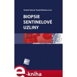 Biopsie sentinelové uzliny - Čestmír Neoral, Tomáš Bohanec – Hledejceny.cz