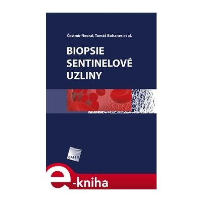 Biopsie sentinelové uzliny - Čestmír Neoral, Tomáš Bohanec – Hledejceny.cz