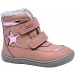 Protetika Linet rosa – Zboží Dáma