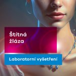 EUC Laboratoře test na funkci štítné žlázy – Hledejceny.cz