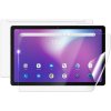 Ochranná fólie pro tablety Screenshield IGET Blackview TAB G11 SE fólie na celé tělo IGT-BVTABG11SE-B