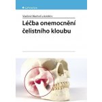 Léčba onemocnění čelistního kloubu - Vladimír Machoň, kolektiv a – Hledejceny.cz
