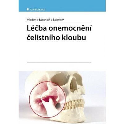 Léčba onemocnění čelistního kloubu - Vladimír Machoň, kolektiv a – Zbozi.Blesk.cz