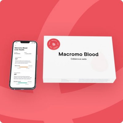 Macromo domácí krevní test zdravá játra – Zboží Mobilmania