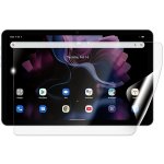 Screenshield IGET Blackview TAB G16 fólie na displej IGT-BVTABG16-D – Zboží Živě