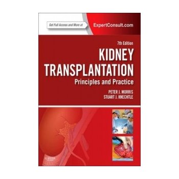 Kidney Transplantation