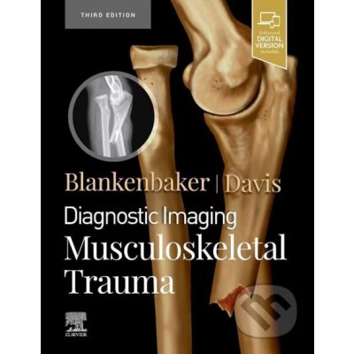 Diagnostic Imaging: Musculoskeletal Trauma - Donna G. Blankenbaker, Kirkland W. Davis – Hledejceny.cz