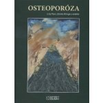 Osteoporóza - Juraj Payer, Zdenko Killinger – Sleviste.cz