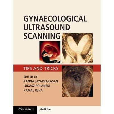 Gynaecological Ultrasound Scanning - Tips and Tricks Jayaprakasan KannaPaperback – Zbozi.Blesk.cz