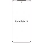 Ochranná fólie Hydrogel Xiaomi Redmi Note 10 – Zboží Živě