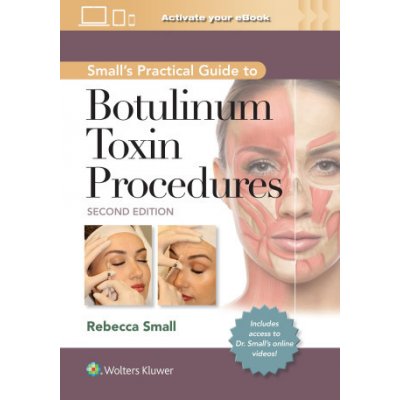 Small's Practical Guide to Botulinum Toxin Procedures – Zbozi.Blesk.cz