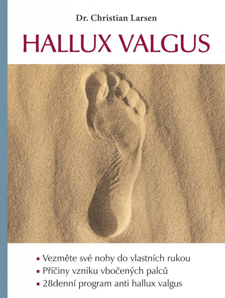 Hallux valgus - Larsen Christian