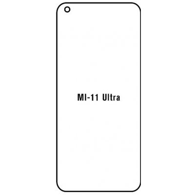 Ochranná fólie Hydrogel Xiaomi Mi 11 Ultra – Zbozi.Blesk.cz