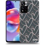 Pouzdro Picasee ULTIMATE CASE Xiaomi Redmi Note 11 Pro+ 5G - Lots of love – Hledejceny.cz