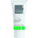 Ziaja Med Antibacterial Care lehký pleťový krém proti akné regulující tvorbu kožního mazu 50 ml – Sleviste.cz