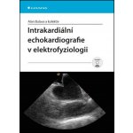 Intrakardiální echokardiografie v elektrofyziologii - Alan Bulava – Hledejceny.cz