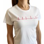 INFINITE MedStyle EKG bílé fibrilace síní – Sleviste.cz