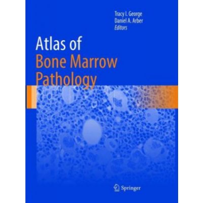 Atlas of Bone Marrow Pathology – Hledejceny.cz