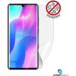 Ochranná fólie Screenshield Xiaomi Mi Note 10 Lite - displej – Hledejceny.cz