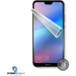 Ochranná fólie Screenshield HUAWEI P20 - displej – Hledejceny.cz