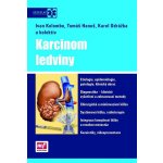 Karcinom ledviny + DVD - doc. MUDr. Karel Odrážka, Ph.D. – Hledejceny.cz