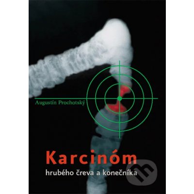 Karcinóm hrubého čreva a konečníka - Augustín Prochotský – Hledejceny.cz