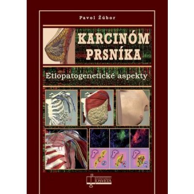 Karcinóm prsníka