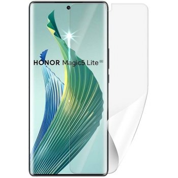 Ochranná fólie ScreenShield HONOR Magic 5 lite 5G - displej